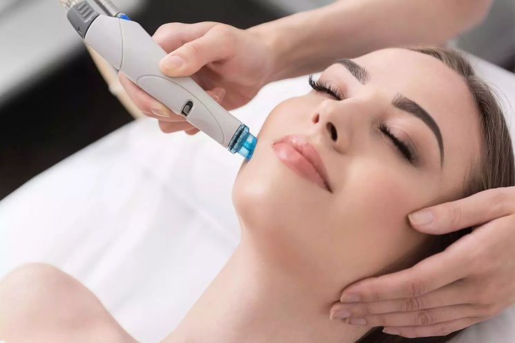 Microneedling Luminosidad Radiante efecto Glass Skin