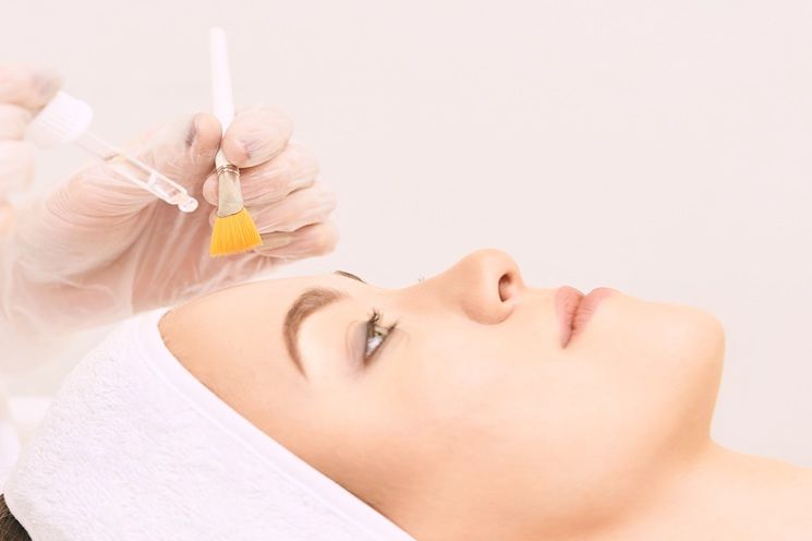 Peeling multiacidos
